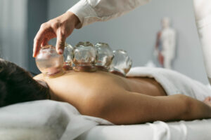 cupping treatment
