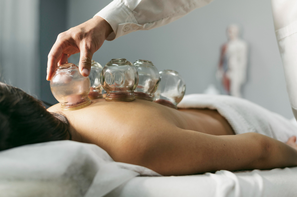 cupping treatment