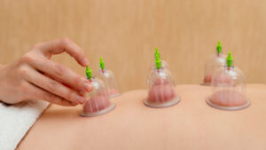 Cupping in Salalah