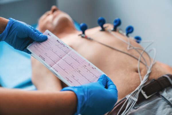 Echocardiography Test in Bangalore: What to Expect & Where to Go Echocardiography Test in Bangalore