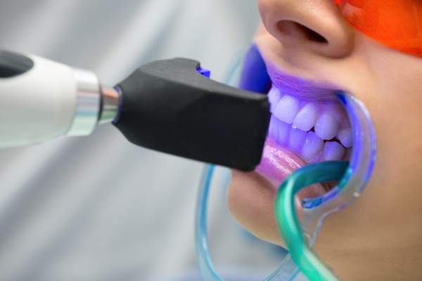 Teeth Whitening Bury
