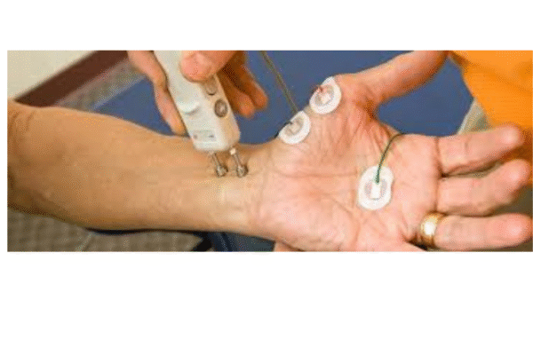 NCV Nerve Test in Bangalore: What to Expect, Benefits & How It Works ncv nerve test in bangalore