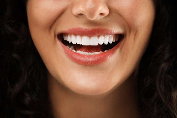 Teeth Whitening Bury