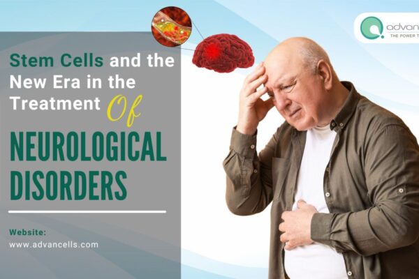 Stem Cells and the New Era in the Treatment of Neurological Disorders Treatment of Neurological Disorders