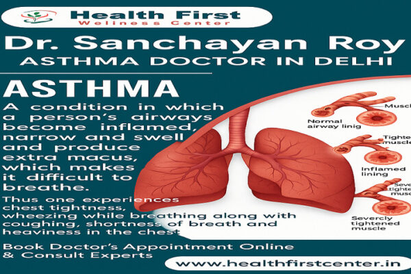 Finding the Right Asthma Specialist: A Guide to Better Breathing Asthma Specialist