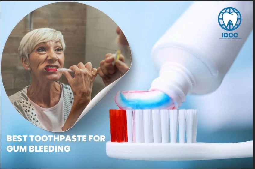 Best-Toothpaste-for-Gum-Bleeding